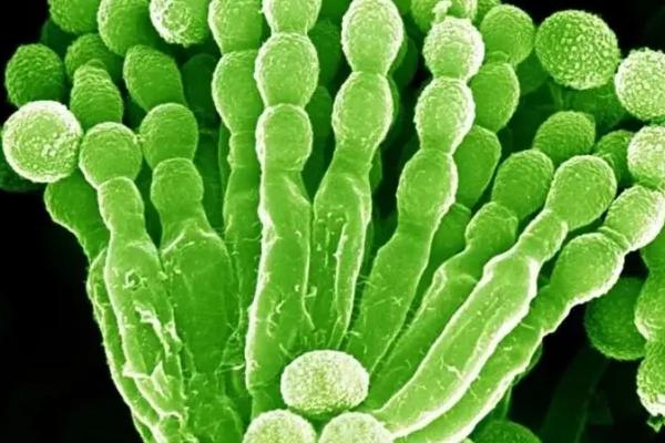 常见的微生物有哪些，有细菌、真菌、病毒等